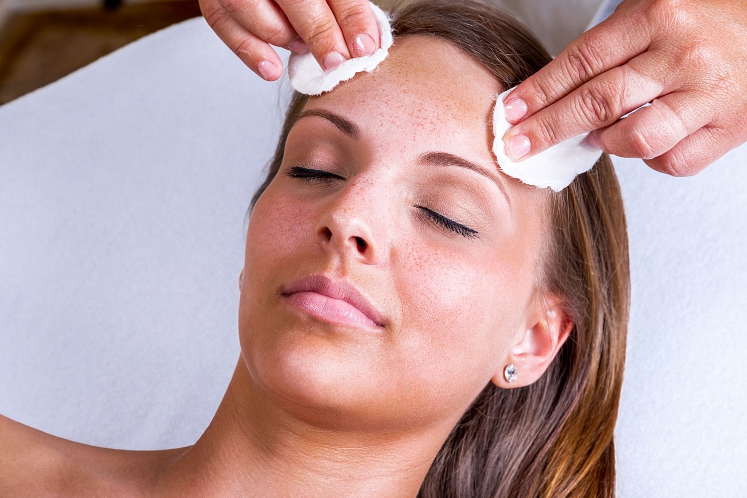 Spring Time Is Perfect for a Chemical Peel