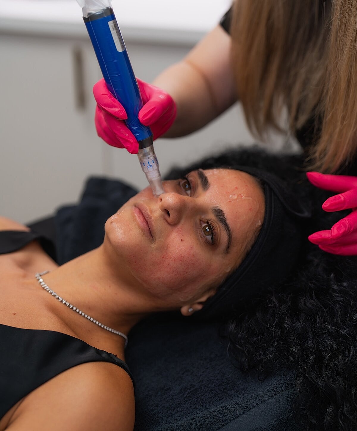 Woman examining lips in mirror at clinic.